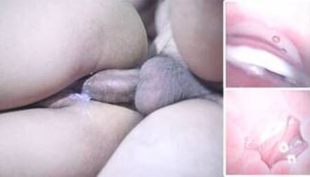Camera inside Vagina after internal Creampie EP2