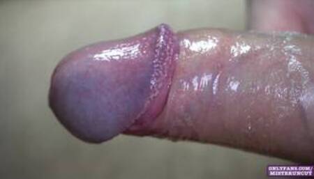 UNCUT COCK CLOSE UP (PEARLY PENILE PAPULES)