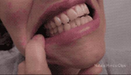 I Had Another Root Canal Today - What It Felt Like And Other Details About My Mouth (mov)