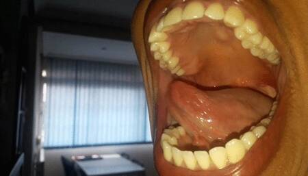 Open mouth Gummy swallow