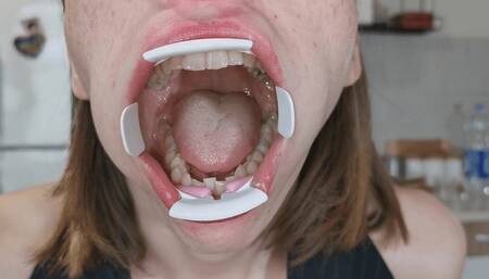 Alanna has a giant mouth-wmv