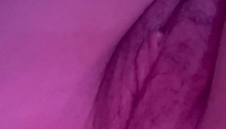 Bruised vagina