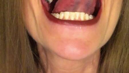 BROWN LIPS, PINK TONGUE & SHARP TEETH