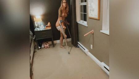 Leg Amputee and White Stockings