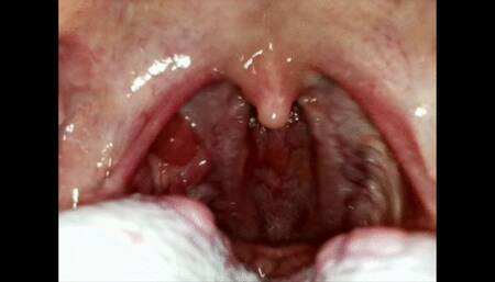 Close up of my throat coughing