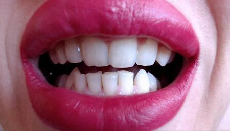 Weird Stasha's teeth