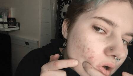 Mini Zit Popping Clip