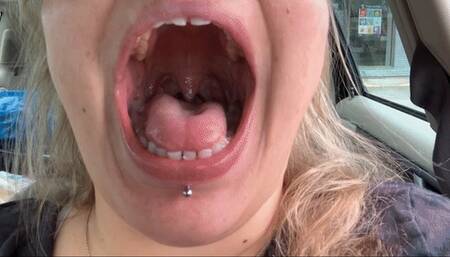 Post Dentist Mouth Tour with Novocaine 480p wmv