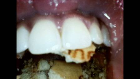 Endoscope camera views of my dirty mouth