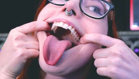 Mouth Tour with New Gold Crown
