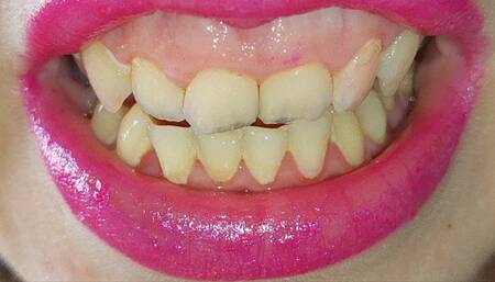 My teeth are chattering - pt8