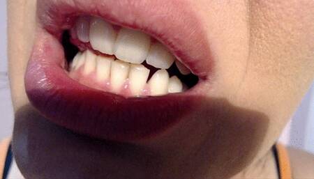 Teeth you like the most