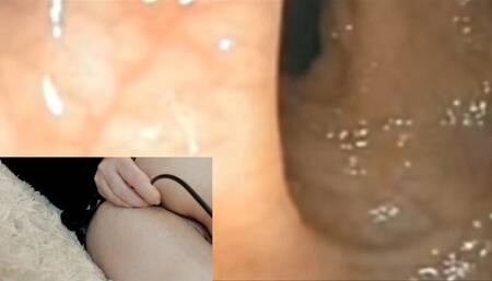 Hardcore anal endoscopy avi