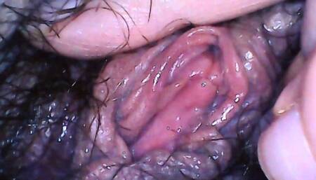 Gynecological medical exploration of a hairy pussy avi