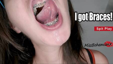 I got Braces! Spit Play and Kisses - First Mouth Tour with Brackets - MissBohemianX - HD MP4