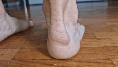 Sexy heel bumps