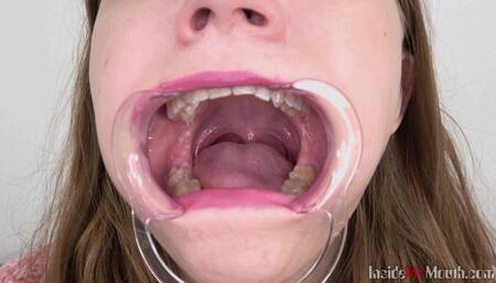 Inside My Mouth - Lola (HD)