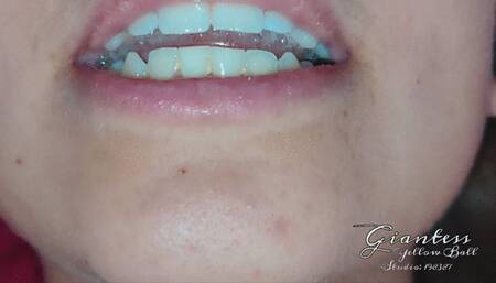 Trapped in saliva game