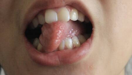 Aurora Licks er Teeth Clean