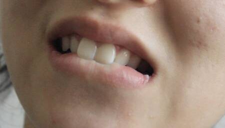 Aurora's Teeth Bite To Your Delight