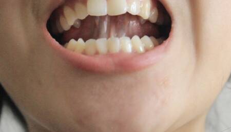 Aurora's Teeth Are A Treasure