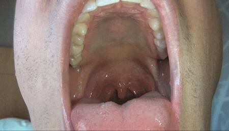 Mark Swallows Tiny Fan! MKV