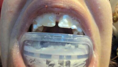 Big mouth and bite for dental treatment