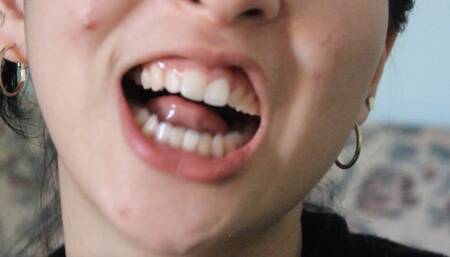 Aurora's Arousing White Teeth