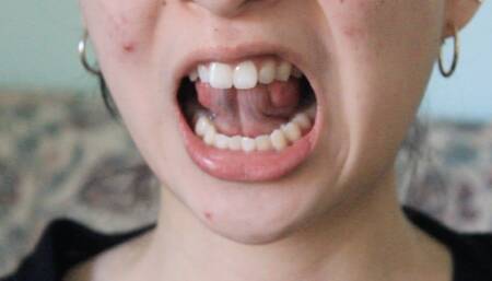 Aurora's Teeth Teases