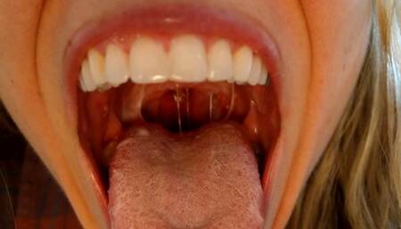 uvula  yogurt spit strings and endoscope