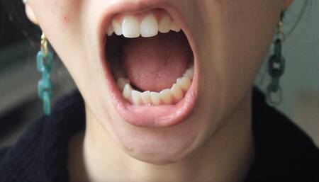 Aurora Opens Her Sexy Mouth