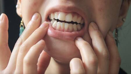 Aurora's Lovely Teeth Seduce You Part 2