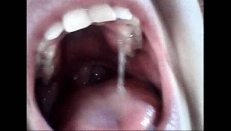 Endoscopy yawning