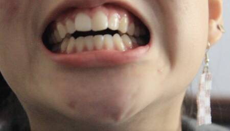 Aurora's Gorgeous Teeth Part 2