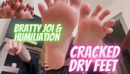 Dirty Dry Feet Humiliating JOI