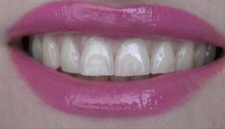 You have outstanding sharp and pointy teeth MP4 FULL HD 1080p