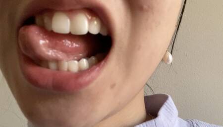 Let Aurora's Teeth Tempt You Madly