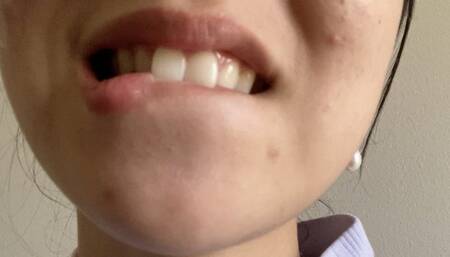 Let Aurora's Teeth Tempt You Madly Part 2