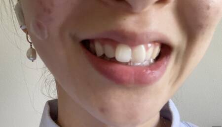 Let Aurora's Teeth Tempt You Madly Part 3