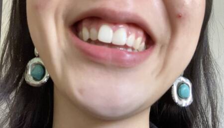 Let Aurora's Teeth Tempt You Madly Part 4