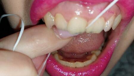 dental floss - part 6