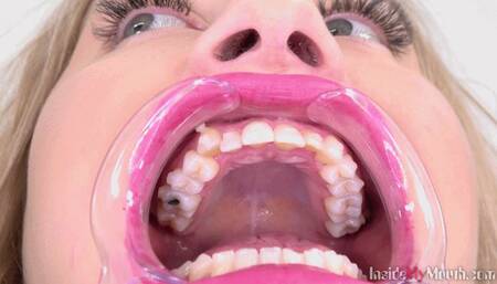 Inside My Mouth - Cayla Lyons (HD)