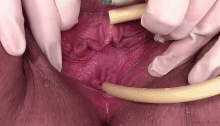 catheter and surgical gloves