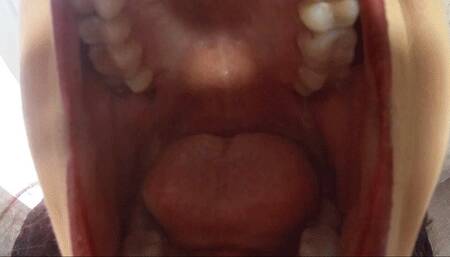 Inside my mouth with gummy bears