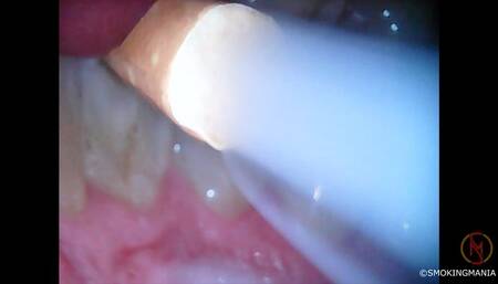 JOY superslisms inside 2