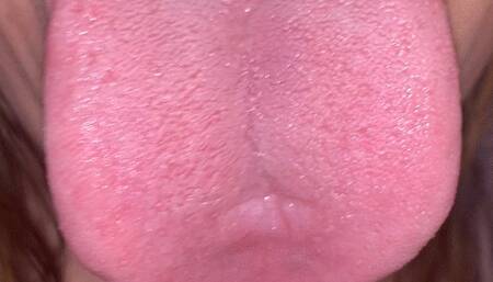 Take a look inside my mouth