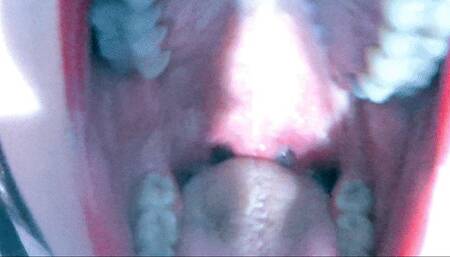 Extreme close-up mouth check