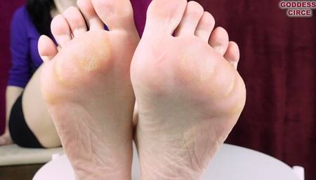 DO YOU LOVE MY CALLUSES? EAT THEM!