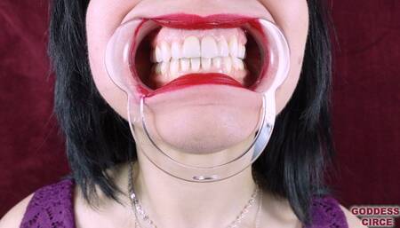 DENTAL MOUTH SPREADER: EXTREME CLOSE-UPS OF MY TEETH AND MOUTH (Video request)