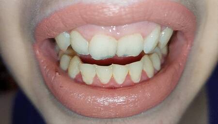 teeth tour - admire my teeth